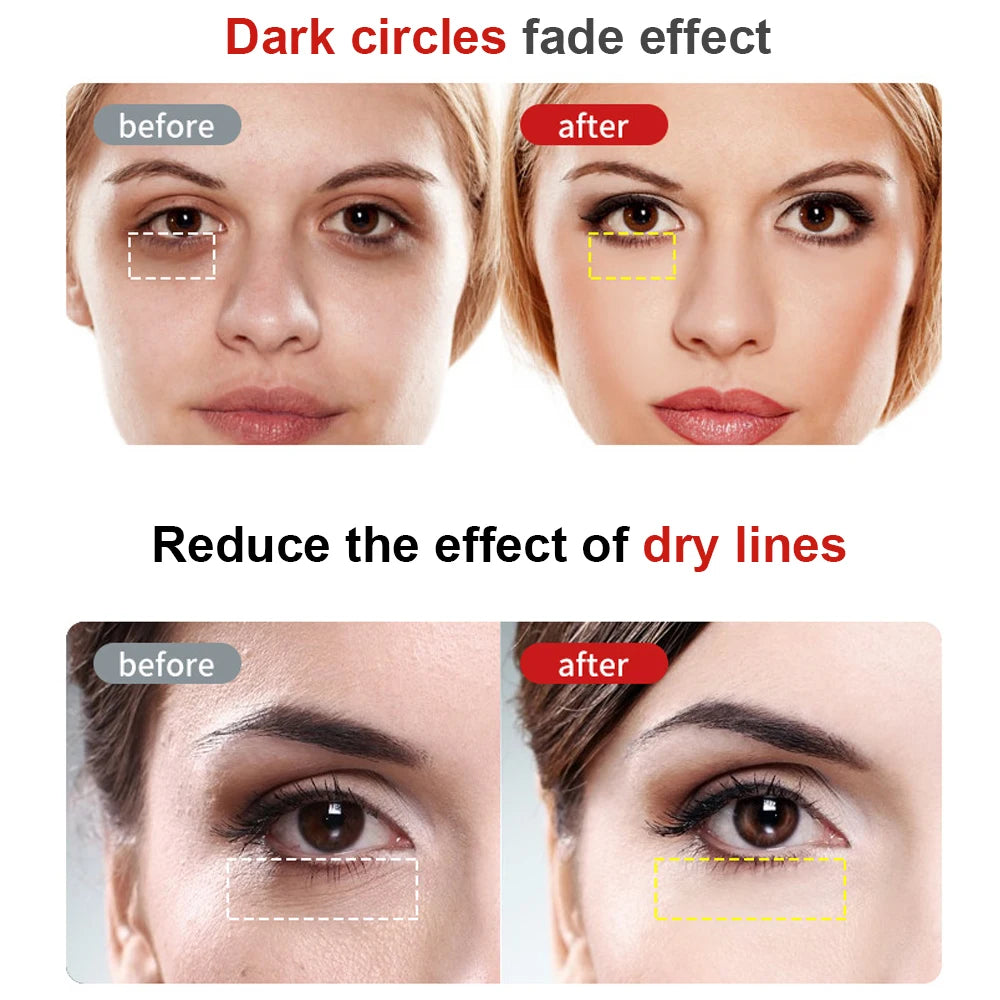Radiance Eye Lift Massager