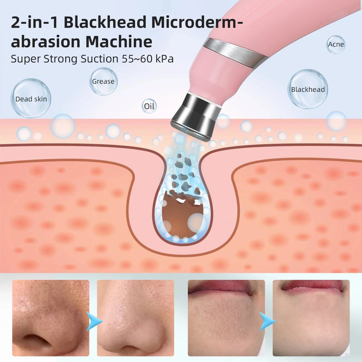 Portable Diamond Microdermabrasion Machine