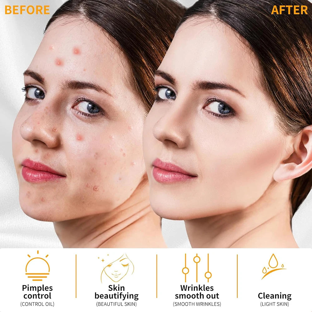 Skin Tightening & Anti-Aging Beauty Tool