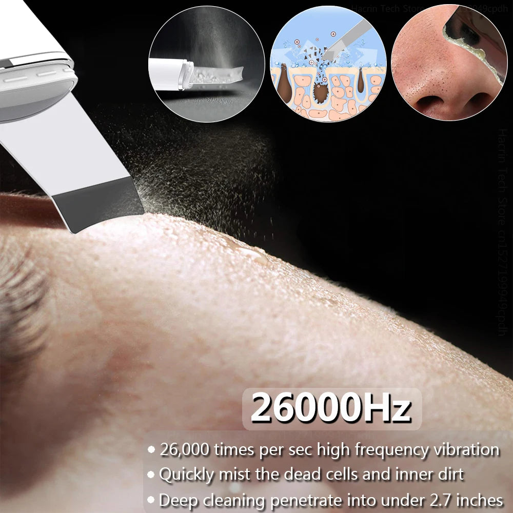 GlowSonic™ Ultrasonic Facial Scrubber
