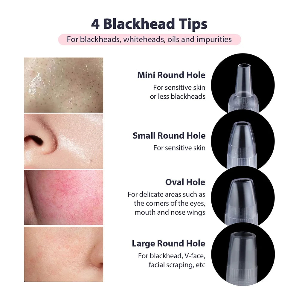 Portable Diamond Microdermabrasion Machine