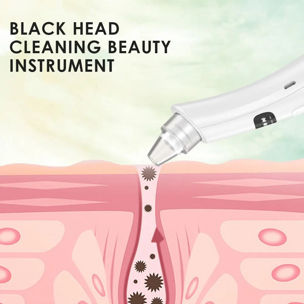 GlowVac™ 3-Mode Face Cleansing & Blackhead Removal Vacuum