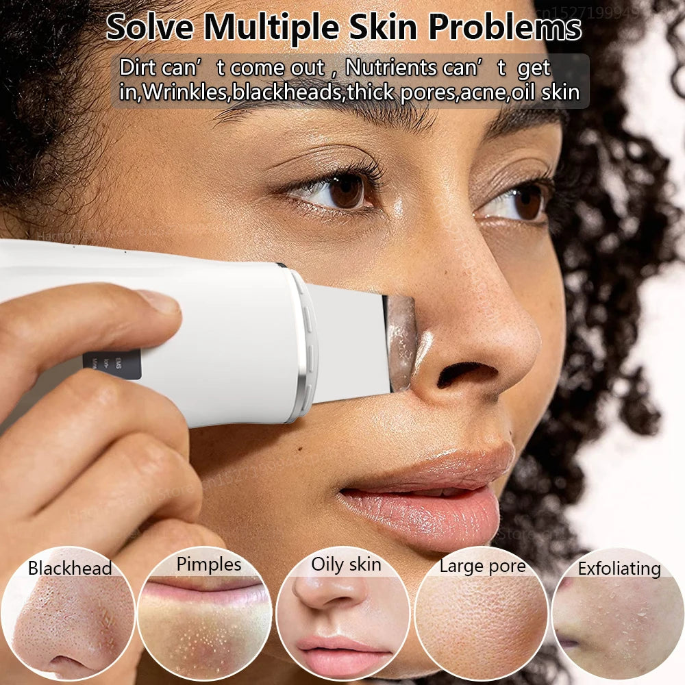 GlowSonic™ Ultrasonic Facial Scrubber