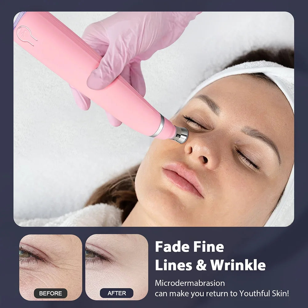 Portable Diamond Microdermabrasion Machine