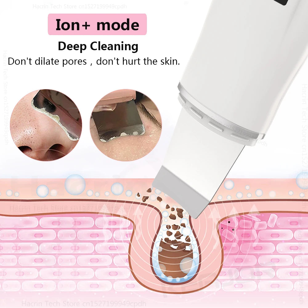 GlowSonic™ Ultrasonic Facial Scrubber