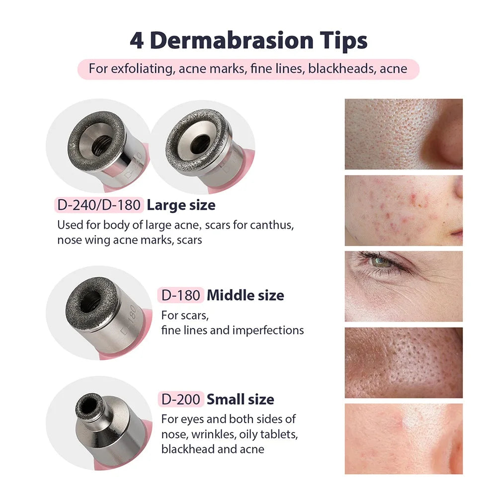 Portable Diamond Microdermabrasion Machine