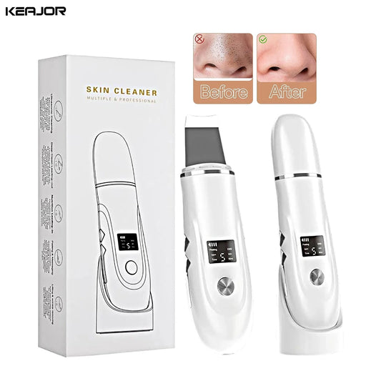 GlowSonic™ Ultrasonic Facial Scrubber